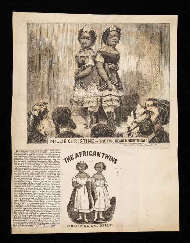 Ein Blatt mit einer Zeichnung von siamesischen Zwillingen Millie und Christine, die nebeneinander stehen, mit beschreibendem Text.